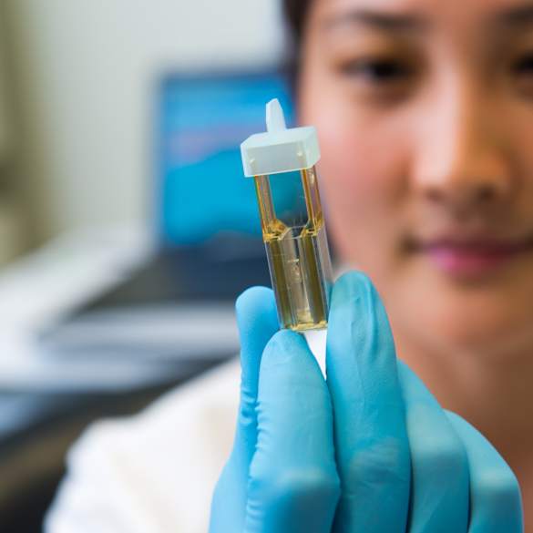 Scientist holding tissue sample.